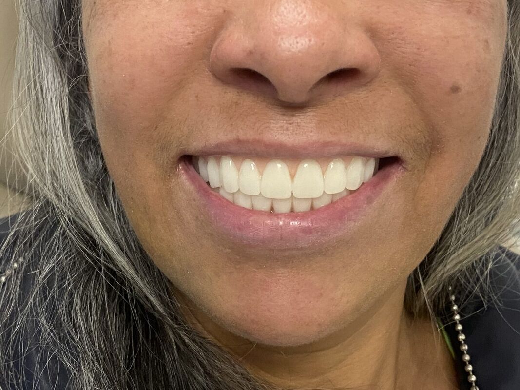 Sorriso de paciente da A&A Dental Clinic após o tratamento